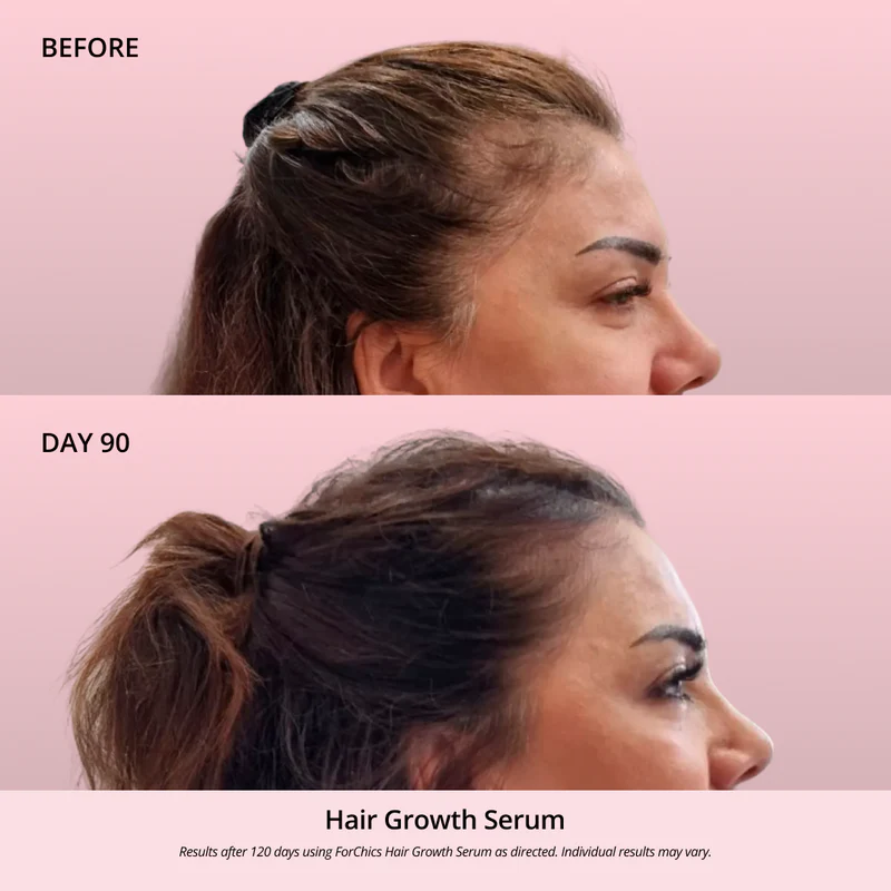 Hair Growth Oil Spray