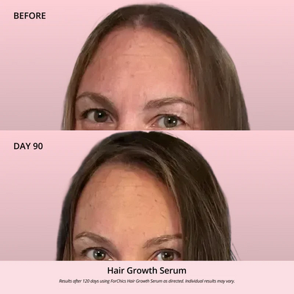 Hair Growth Oil Spray